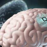 El autismo es una condición, no una enfermedad 